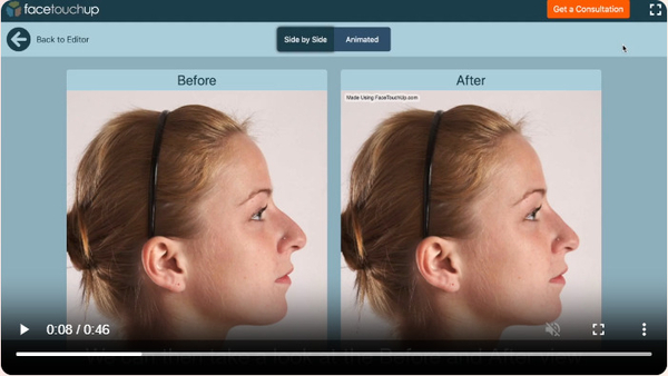 Download Plastic Surgery Visualization with FaceTouchUp: Simulate Your Nose Job with Ease