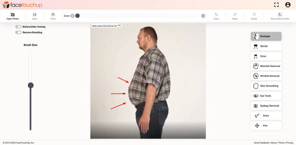 Download Simulate Bariatric Surgery with FaceTouchUp: Visualize Your Transformation Before Surgery