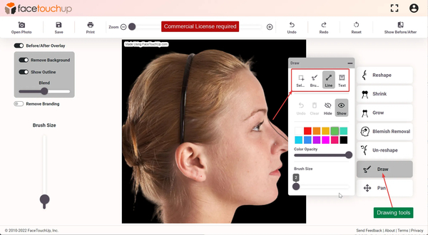 Download Simulate Nose Job with AI Rhinoplasty Simulator | FaceTouchUp