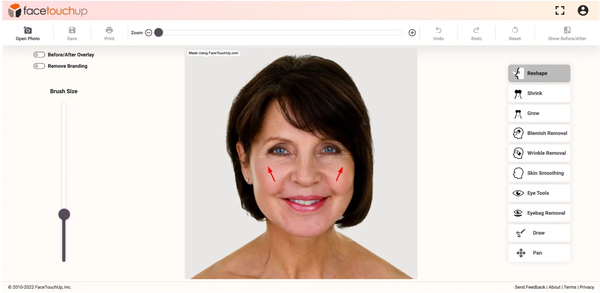 Download Simulate Face Lift Online | Try the FaceTouchUp Face Lift Simulator