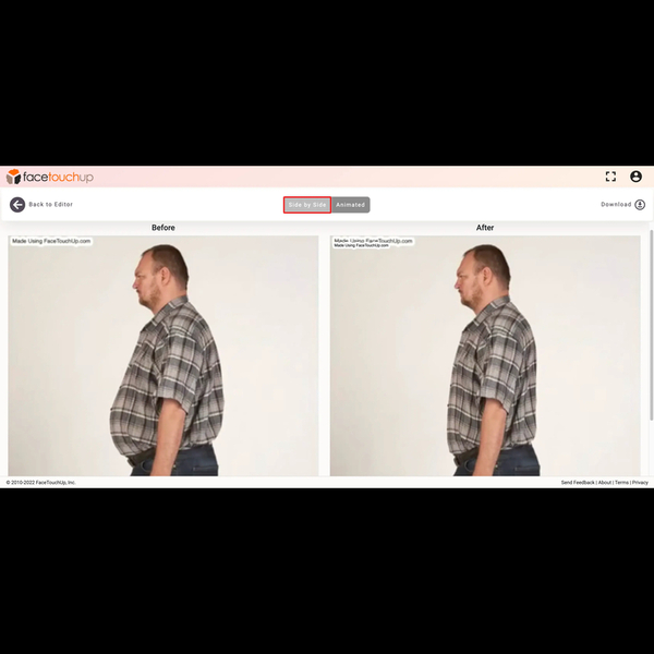 Download simulate-bariatric-surgery-step-7.jpg