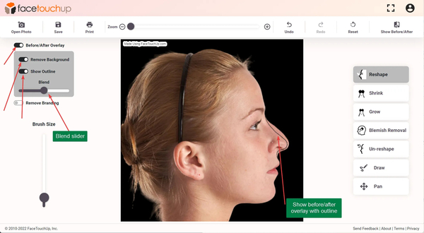 Download Plastic Surgery Visualization with FaceTouchUp: Simulate Your Nose Job with Ease