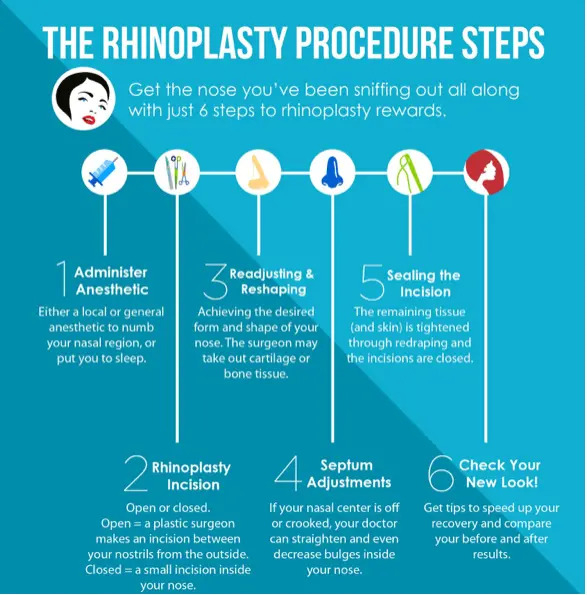 Download rhinoplasty-steps.jpg