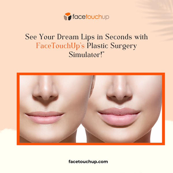 Download How to virtually simulate Chin Augmentation & Neck Lift (lower rhytidectomy)